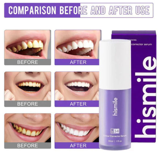 Hismile V34 Colour Corrector